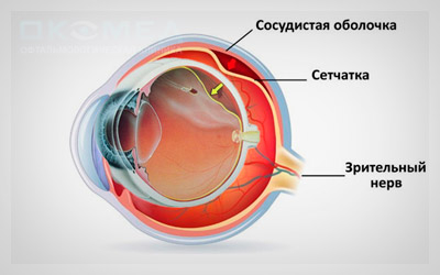 Регматогенная отслойка сетчатки — лечение в Москве