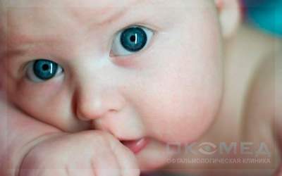Заболевания глаз у новорожденных