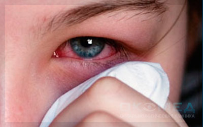 вирусные болезни глаз