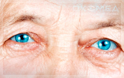 Метод лазерной хирургии диабетической ретинопатии